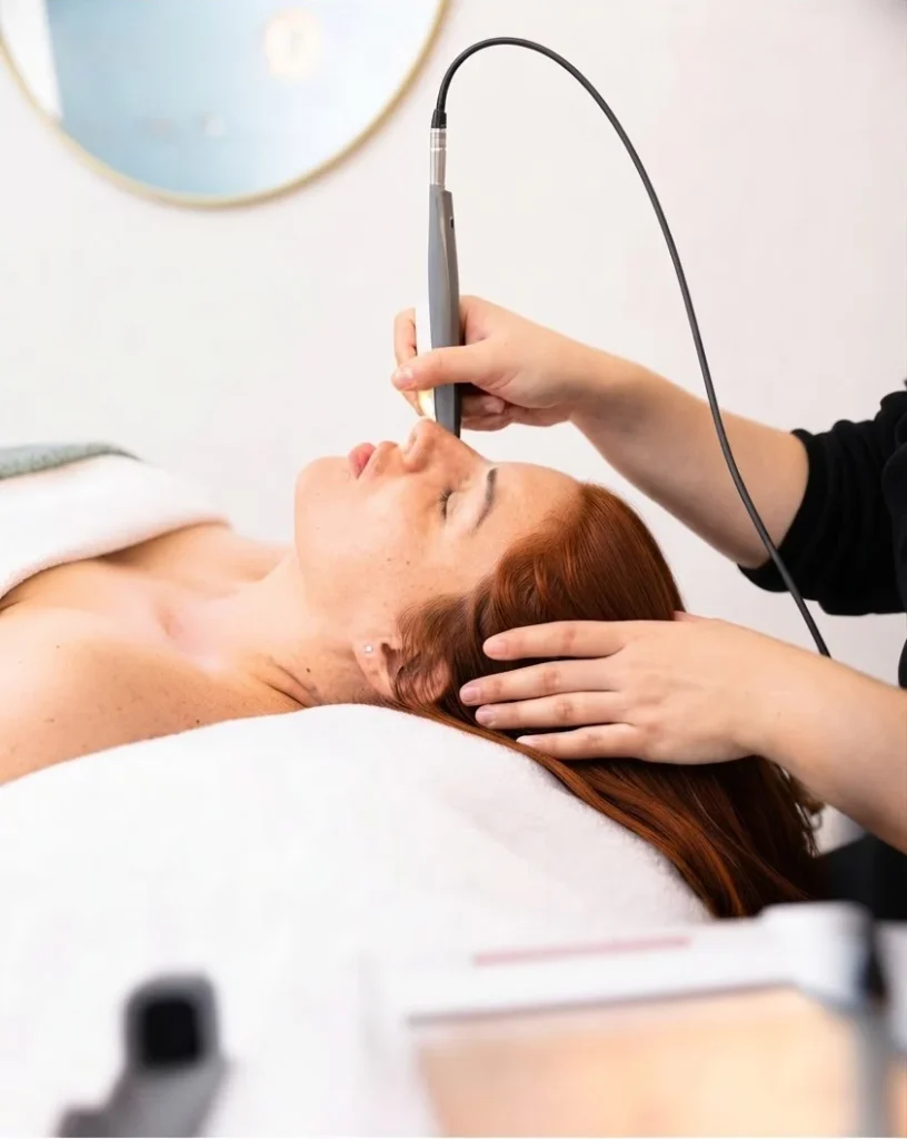 Séance de Luxopuncture® : la praticienne applique le stylet infrarouge sur le front d'une cliente allongée